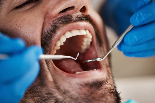 Best 24-Hour Emergency Dental Care in Lanse, MI