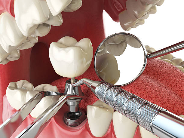 Best After-Hours Dental Care in Lanse, MI